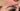 prp prp injection plasma injections natural lip fillers prp injection cost vampire facial cost prp under eyes prp cost prf treatment prp injection knee platelet rich plasma injection natural looking lip fillers prp injections near me prp injections for face natural lip injections ez gel ez gel substitute ez gel filler