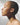 HOW DOES MOUTH BREATHING AFFECT YOUR FACIAL INJECTIONS?