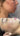 hyperpigmentation, pigmentation skin, cosmelan 2, pih skin, skin hyperpigmentation, postinflammatory hyperpigmentation, melanin pigmentation, hyperpigmentation spots, hyperpigmentation cause, what hyperpigmentation, PIE