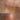 hyperpigmentation, pigmentation skin, cosmelan 2, pih skin, skin hyperpigmentation, postinflammatory hyperpigmentation, melanin pigmentation, hyperpigmentation spots, hyperpigmentation cause, what hyperpigmentation