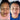 nodular acne, facial scars, acne before and afters, ice pick scars, pimple scars, facials for acne near me, acne extraction, benzoyl peroxide before and after