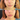 rha, rha collection, rha 2, rha 3, rha 4, filler near me, chin filler, cheek filler, under eye filler, restylane
