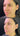 prp prp injection plasma injections natural lip fillers prp injection cost vampire facial cost prp under eyes prp cost prf treatment prp injection knee platelet rich plasma injection natural looking lip fillers prp injections near me prp injections for face natural lip injections ez gel ez gel substitute ez gel filler