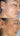 hyperpigmentation, pigmentation skin, cosmelan 2, pih skin, skin hyperpigmentation, postinflammatory hyperpigmentation, melanin pigmentation, hyperpigmentation spots, hyperpigmentation cause, what hyperpigmentation,enlighten peel reveskin enlighten peel before and after enlighten peel near me enlighten rx reveskin peel lereve skincare reve enlighten peel