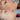 hyperpigmentation, pigmentation skin, cosmelan 2, pih skin, skin hyperpigmentation, postinflammatory hyperpigmentation, melanin pigmentation, hyperpigmentation spots, hyperpigmentation cause, what hyperpigmentation