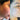 nodular acne, facial scars, acne before and afters, ice pick scars, pimple scars, facials for acne near me, acne extraction, benzoyl peroxide before and after