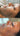 hyperpigmentation, pigmentation skin, cosmelan 2, pih skin, skin hyperpigmentation, postinflammatory hyperpigmentation, melanin pigmentation, hyperpigmentation spots, hyperpigmentation cause, what hyperpigmentation, melasma specialist, mesoestetic cosmelan, cosmelan peel, cosmelan 2, dermamelan, cosmelan peel near me, cosmelan 1, cosmelan treatment, mesoestetic, cosmelan, dermamelan treatment, mesoestetic, cosmelan 2, cosmelan before and after, pigmentation specialist