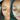 hyperpigmentation, pigmentation skin, cosmelan 2, pih skin, skin hyperpigmentation, postinflammatory hyperpigmentation, melanin pigmentation, hyperpigmentation spots, hyperpigmentation cause, what hyperpigmentation
