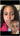 hyperpigmentation, pigmentation skin, cosmelan 2, pih skin, skin hyperpigmentation, postinflammatory hyperpigmentation, melanin pigmentation, hyperpigmentation spots, hyperpigmentation cause, what hyperpigmentation