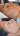 nodular acne, facial scars, acne before and afters, ice pick scars, pimple scars, facials for acne near me, acne extraction, benzoyl peroxide before and after