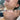 nodular acne, facial scars, acne before and afters, ice pick scars, pimple scars, facials for acne near me, acne extraction, benzoyl peroxide before and after