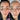 hyperpigmentation, pigmentation skin, cosmelan 2, pih skin, skin hyperpigmentation, postinflammatory hyperpigmentation, melanin pigmentation, hyperpigmentation spots, hyperpigmentation cause, what hyperpigmentation, melasma specialist, mesoestetic cosmelan, cosmelan peel, cosmelan 2, dermamelan, cosmelan peel near me, cosmelan 1, cosmelan treatment, mesoestetic, cosmelan, dermamelan treatment, mesoestetic, cosmelan 2, cosmelan before and after, pigmentation specialist
