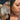 hyperpigmentation, pigmentation skin, cosmelan 2, pih skin, skin hyperpigmentation, postinflammatory hyperpigmentation, melanin pigmentation, hyperpigmentation spots, hyperpigmentation cause, what hyperpigmentation