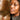 nodular acne, facial scars, acne before and afters, ice pick scars, pimple scars, facials for acne near me, acne extraction, benzoyl peroxide before and after
