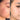 nodular acne, facial scars, acne before and afters, ice pick scars, pimple scars, facials for acne near me, acne extraction, benzoyl peroxide before and after