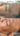 hyperpigmentation, pigmentation skin, cosmelan 2, pih skin, skin hyperpigmentation, postinflammatory hyperpigmentation, melanin pigmentation, hyperpigmentation spots, hyperpigmentation cause, what hyperpigmentation